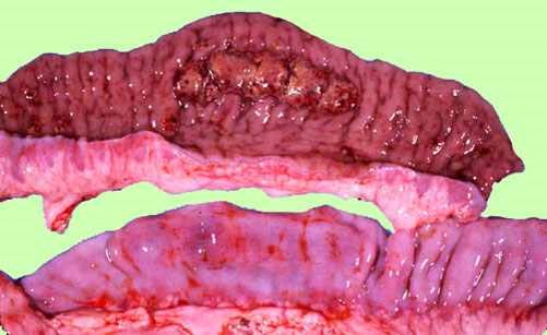 الإسهال الفيروسي البقري Bovine Viral Diarrhea : موات وفقدان لطع باير . هبوط في خطوط المخاطية نتيجة فقدان النسيج اليمفاوي . أحتقان المصلية.