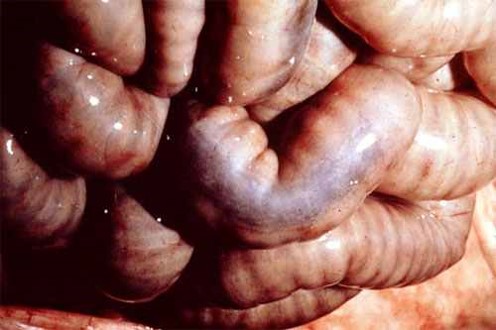 الإسهال الفيروسي البقري Bovine Viral Diarrhea : السطح المصلي للأمعاء يظهر موات لطع باير مع تلوين أسود مزرق (داء الميلانين الكاذب).