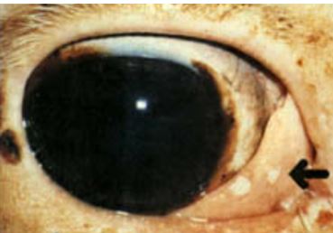 10-eye-tumor ورم حليمي كامل النمو في بقره
