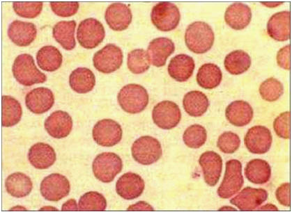 فقر الدم (15) : كريات الدم الحمراء للكلب