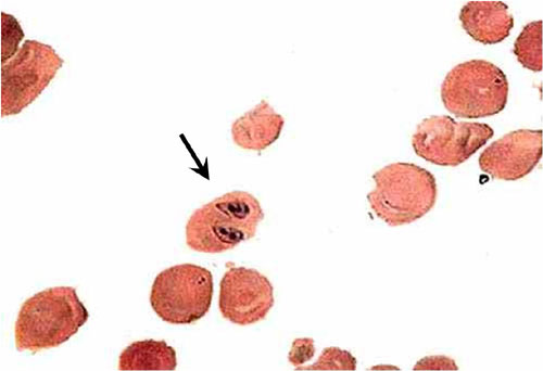 فقر الدم البابيزيا (Babesiosis) : بابيزيا كلابية