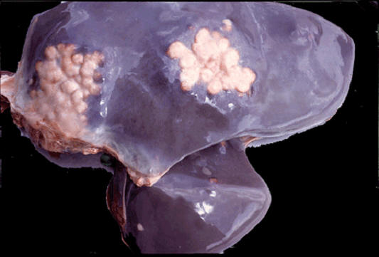 tuberculosis صورة( 11 ) : كبد بقرة حبيبومات السل