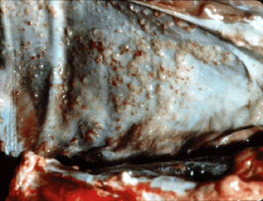  tuberculosis صورة( 29 ) : الغشاء البريتوني لبقرة - العديد من عقد حبيبومات السل 