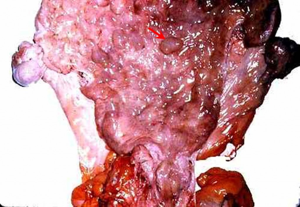 صورة (29): مخاطية الرحم مع تحوصل غدد بطانته فى فرسة , تحوصل غدد بطانة الرحم