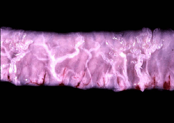 صورة (5) paratuberculosis : شبيه الدرن في الامعاء الدقيقة لغنمة تضخم الاوعية الليمفاوية على السطح المصلي للامعاء