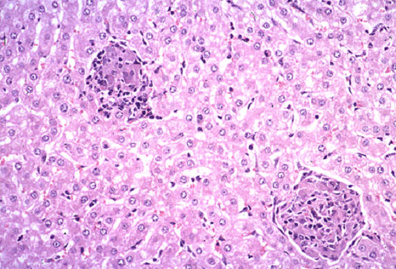 صورة (9) paratuberculosis : حبيبومات شبيه الدرن في كبد غنمة