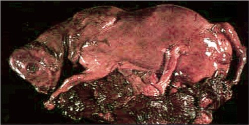 Neospora إجهاض النيوسبورا تيبس المفاصل (arthrogryposis) في عجل مجهض