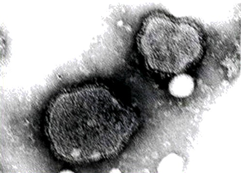 Peste des petitis ruminants فيروس طاعون المجترات الصغيرة : فيروس أشباه الفيروسات المخاطية – جنس فيروس شبيه فيروس الحصبة