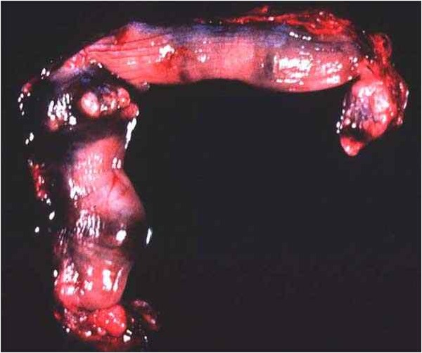 Subinvolution of placental sites رحم كلبة : يمكن رؤية التضخم المستطيل لبطانة الرحم من السطح المصلي