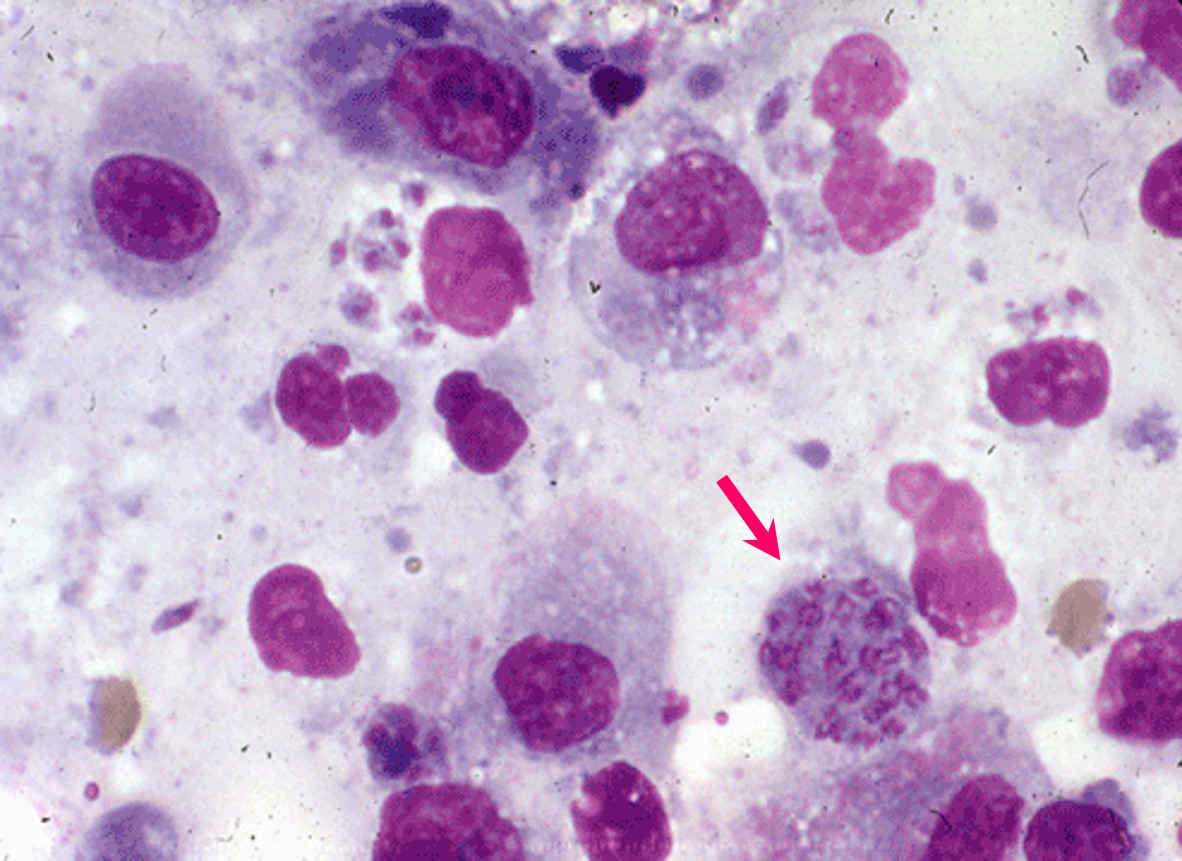 Toxoplasmosis داء المقوسات كيس بوغي للمقوسات(toxoplasma sporocyst) 
