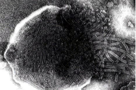 cattle plague فيروس الطاعون البقري فيروس شبيه الفيروسات المخاطية – خيط وحيد من حامض الريبوز النووي