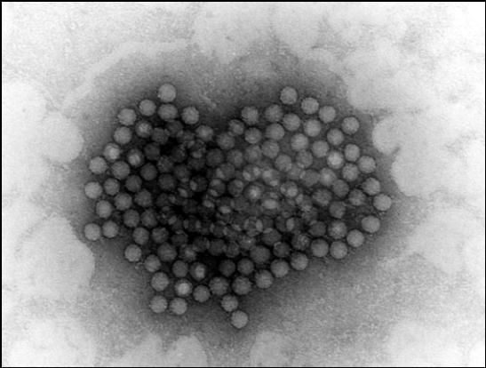فيروس الحمى القلاعية Foot and mouth disease virus بالميكروسكوب الالكتروني