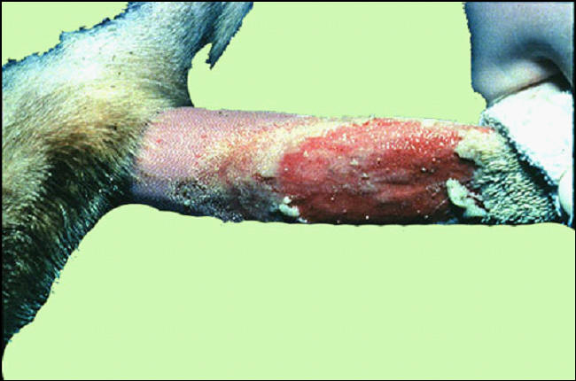 Foot and mouth diseases حمى قلاعية : انسلاخ الغطاء الطلائى للحويصلات تاركا تآكلات .