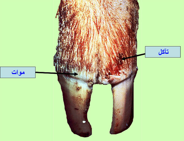 الطفح الحويصلى للخنازير vesicular exanthema of swine : حويصلة منفجرة على الحزام التاجي وبهتان لونه 