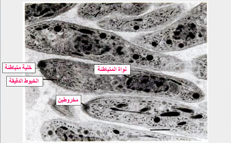 تركيبة حويصلة البسنيوتا Besnoitia بالمجهر الإلكتروني : عديد من المتباطئات الهلالية أو الكمثرية في الفجوة الطفيلية